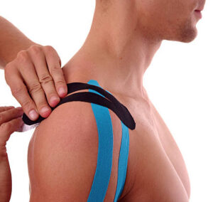 Taping Neuromuscolare